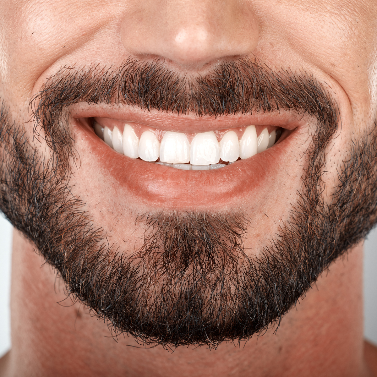 Close-up of healthy restored teeth